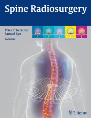 Książka Spine Radiosurgery Peter Gerszten