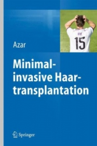 Könyv Minimalinvasive Haartransplantation Reza P. Azar