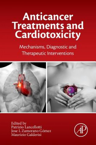 Kniha Anticancer Treatments and Cardiotoxicity Patrizio Lancellotti