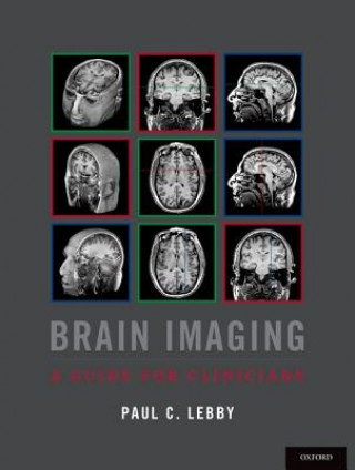 Kniha Brain Imaging Paul C. Lebby