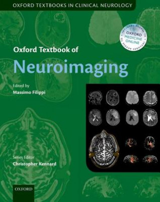 Książka Oxford Textbook of Neuroimaging Massimo Filippi