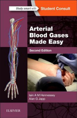 Książka Arterial Blood Gases Made Easy Iain Hennessey