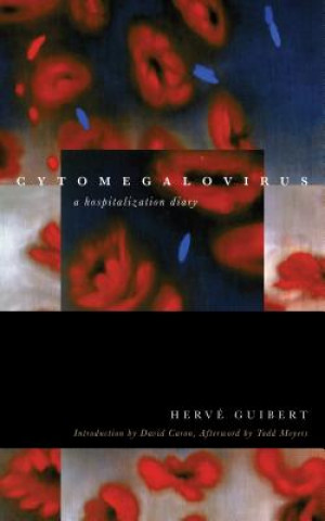 Könyv Cytomegalovirus Herve Guibert
