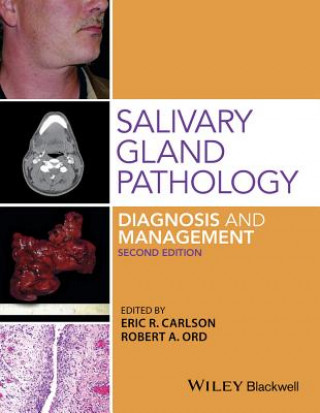 Carte Salivary Gland Pathology Eric Carlson