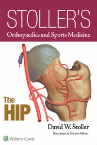 E-kniha Stoller's Orthopaedics and Sports Medicine: The Hip David W. Stoller