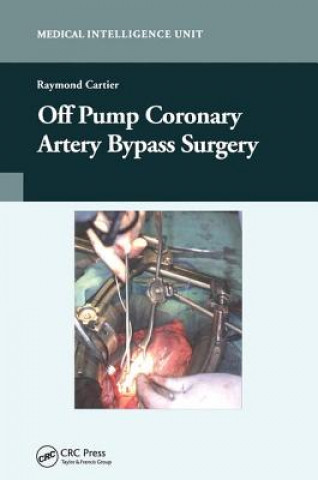 Book Off-Pump Coronary Artery Bypass Surgery Raymond Cartier