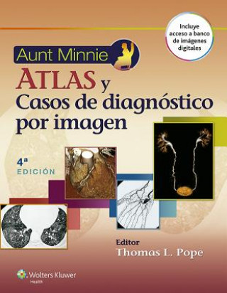 Carte Aunt Minnie. Atlas y casos de diagnostico por imagen Thomas L. Pope