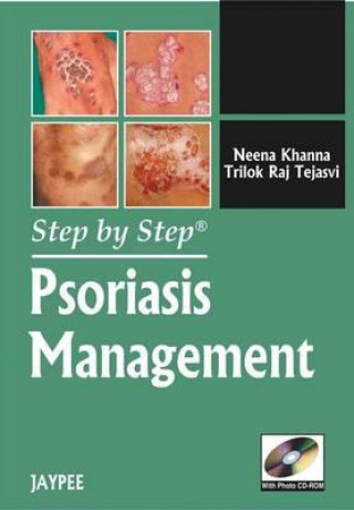 Kniha Step by Step: Psoriasis Management Neema Khanna