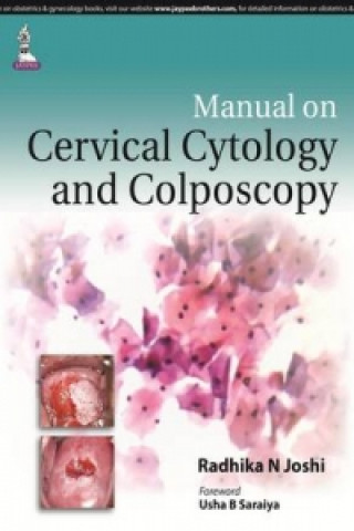 Knjiga Manual on Cervical Cytology and Colposcopy Radhika N. Joshi