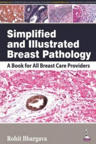 Könyv Simplified and Illustrated Breast Pathology Rohit Bhargava