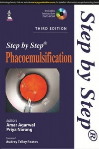 Book Step by Step Phacoemulsification Amar Agarwal