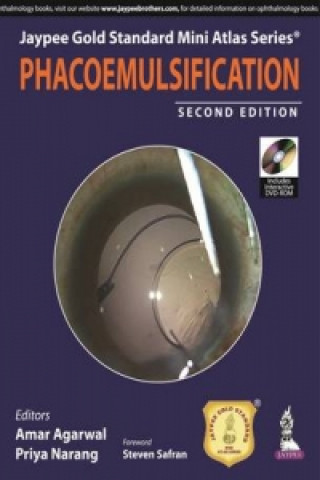 Kniha Jaypee Gold Standard Mini Atlas Series: Phacoemulsification 