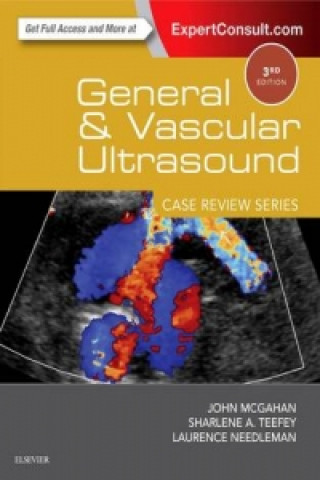 Könyv General and Vascular Ultrasound: Case Review John P. McGahan