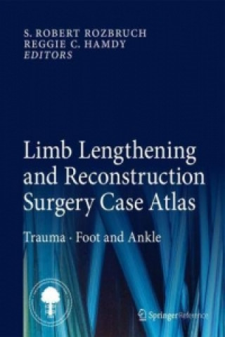 Książka Limb Lengthening and Reconstruction Surgery Case Atlas S. Robert Rozbruch