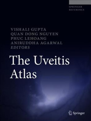 Książka Uveitis Atlas Vishali Gupta