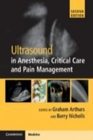 Könyv Ultrasound in Anesthesia, Critical Care and Pain Management with Online Resource Graham Arthurs