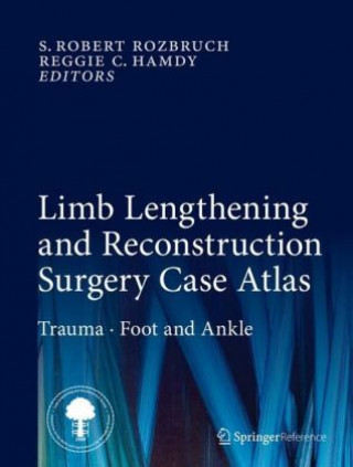 Książka Limb Lengthening and Reconstruction Surgery Case Atlas S. Robert Rozbruch