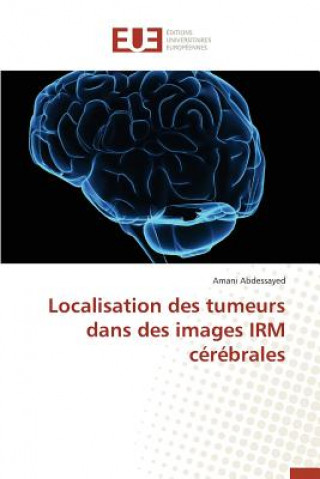 Βιβλίο Localisation Des Tumeurs Dans Des Images Irm C r brales Abdessayed-A