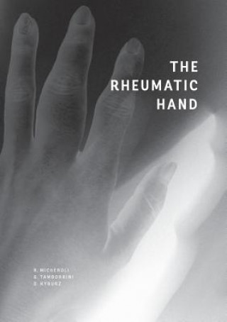 Kniha Rheumatic Hand Raphael Micheroli