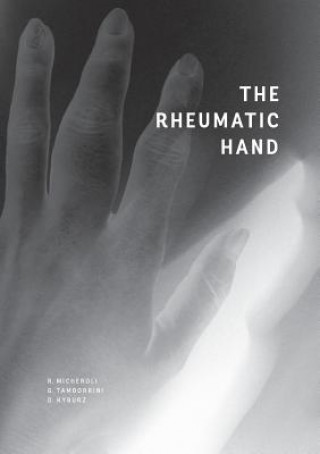 Livre Rheumatic Hand Raphael Micheroli