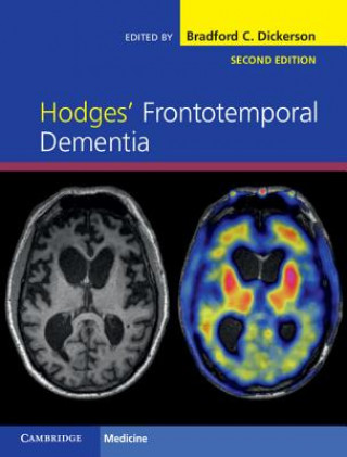 Książka Hodges' Frontotemporal Dementia Bradford C. Dickerson