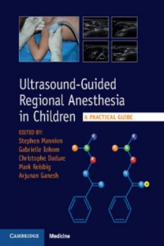 Könyv Ultrasound-Guided Regional Anesthesia in Children Stephen Mannion