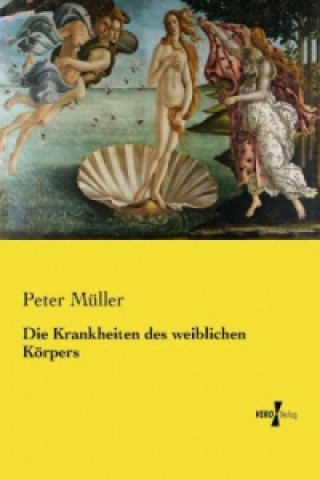 Könyv Die Krankheiten des weiblichen Körpers Peter Müller