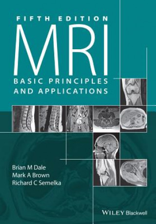 Kniha MRI Basic Principles and Applications, 5e Brian M. Dale