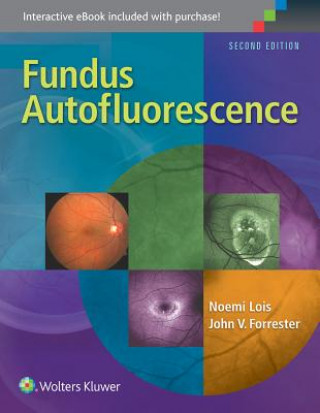 Carte Fundus Autofluorescence Noemi Lois