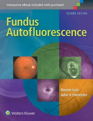 Könyv Fundus Autofluorescence Noemi Lois