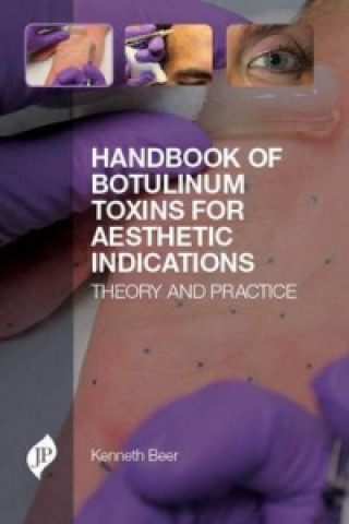 Kniha Handbook of Botulinum Toxins for Aesthetic Indications Kenneth Beer