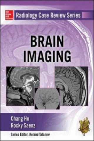 Könyv Radiology Case Review Series: Brain Imaging Chang Ho