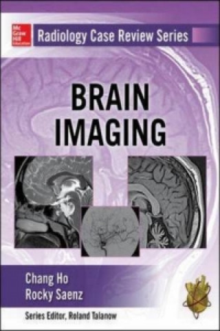 Książka Radiology Case Review Series: Brain Imaging Chang Ho