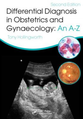 Livre Differential Diagnosis in Obstetrics and Gynaecology: An A-Z Tony Hollingworth