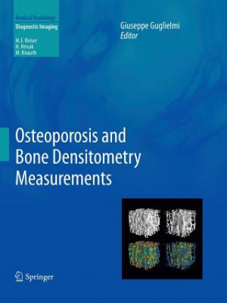 Kniha Osteoporosis and Bone Densitometry Measurements Giuseppe Guglielmi