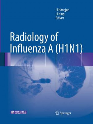 Kniha Radiology of Influenza A (H1N1) Hongjun Li