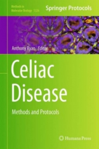 Livre Celiac Disease Anthony Ryan