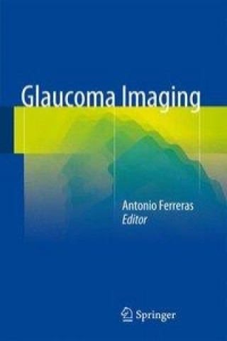 Knjiga Glaucoma Imaging Antonio Ferreras