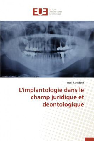 Carte L'Implantologie Dans Le Champ Juridique Et Deontologique Romdane-H