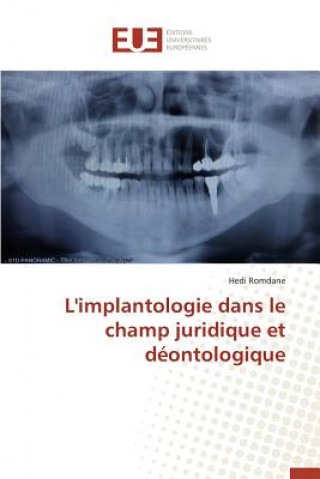 Livre L'Implantologie Dans Le Champ Juridique Et Deontologique Romdane-H