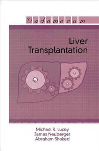 Kniha Liver Transplantation Michael R. Lucey