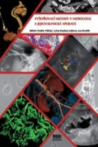 Kniha Vyšetřovací metody v nefrologii a jejich klinická aplikace Ondřej Viklický
