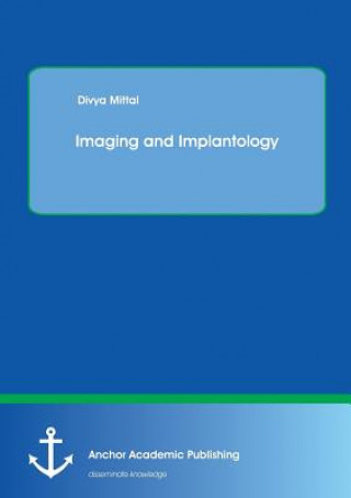 Könyv Imaging and Implantology Divya Mittal