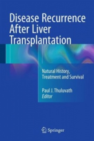 Könyv Disease Recurrence After Liver Transplantation Paul J. Thuluvath