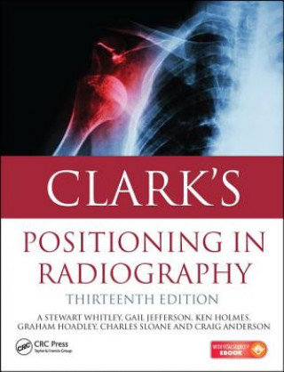 Kniha Clark's Positioning in Radiography 13E A. Stewart Whitley