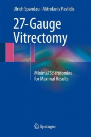 Buch 27-Gauge Vitrectomy Ulrich Spandau