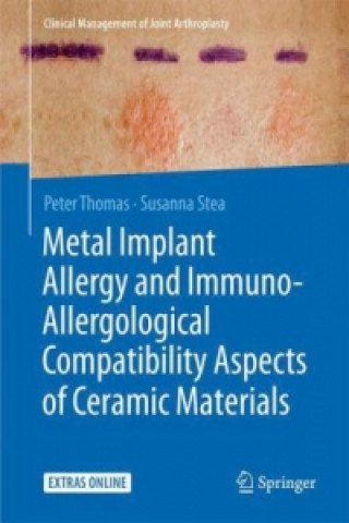 Könyv Metal Implant Allergy and Immuno-Allergological Compatibility Aspects of Ceramic Materials Peter Thomas