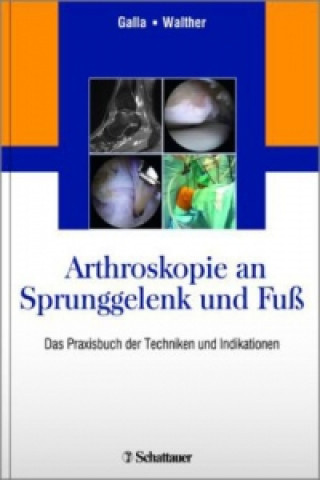 Knjiga Arthroskopie an Sprunggelenk und Fuß Mellany Galla