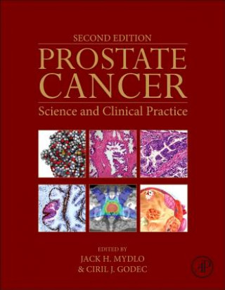 Βιβλίο Prostate Cancer Jack Mydlo