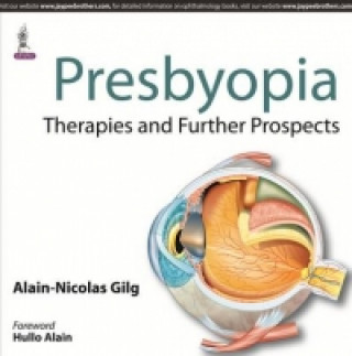 Book Presbyopia Alain-Nicolas Gilg